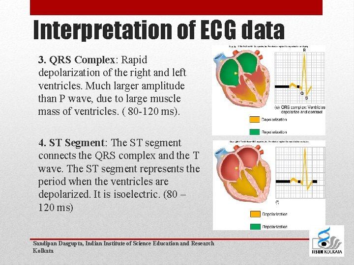 Interpretation of ECG data 3. QRS Complex: Rapid depolarization of the right and left