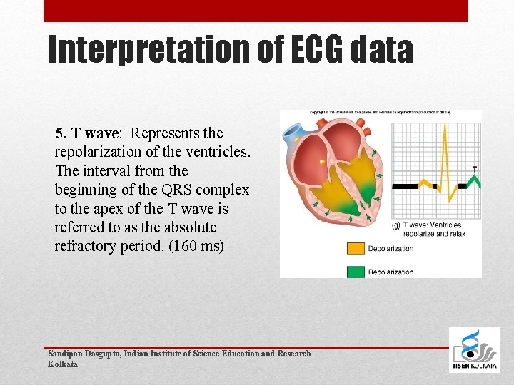 Interpretation of ECG data 5. T wave: Represents the repolarization of the ventricles. The