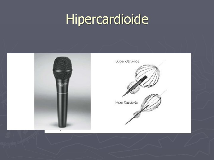 Hipercardioide 