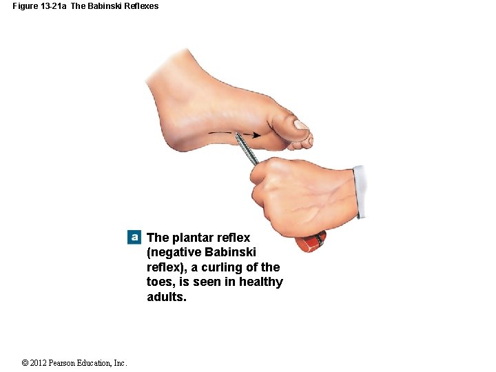 Figure 13 -21 a The Babinski Reflexes The plantar reflex (negative Babinski reflex), a