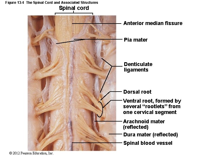 Figure 13 -4 The Spinal Cord and Associated Structures Spinal cord Anterior median fissure
