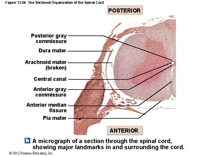 Figure 13 -5 b The Sectional Organization of the Spinal Cord POSTERIOR Posterior gray Figure 13 -5 b The Sectional Organization of the Spinal Cord POSTERIOR Posterior gray
