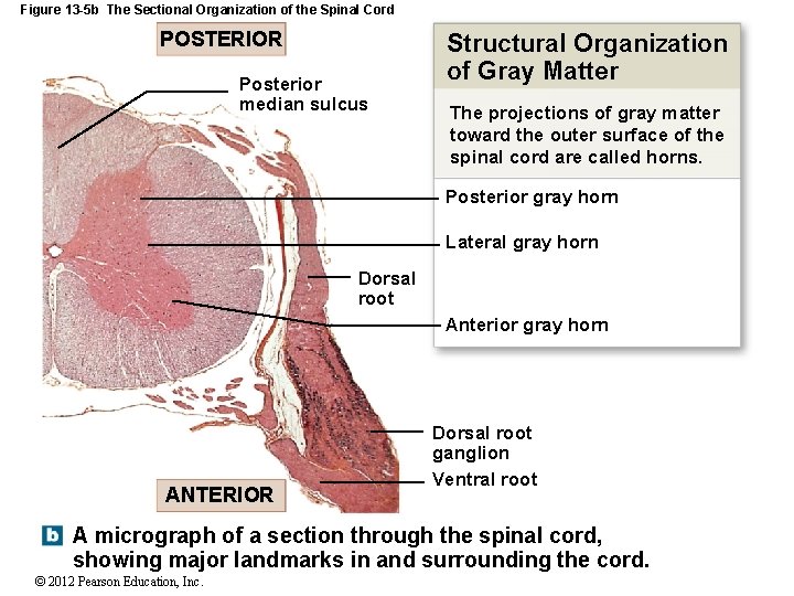 Figure 13 -5 b The Sectional Organization of the Spinal Cord POSTERIOR Posterior median