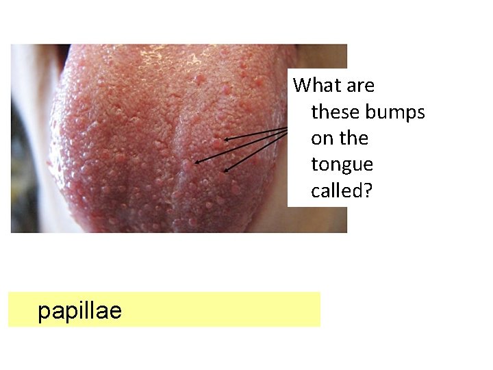 What are these bumps on the tongue called? papillae 