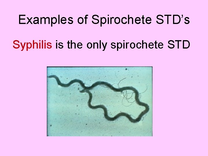 Examples of Spirochete STD’s Syphilis is the only spirochete STD 