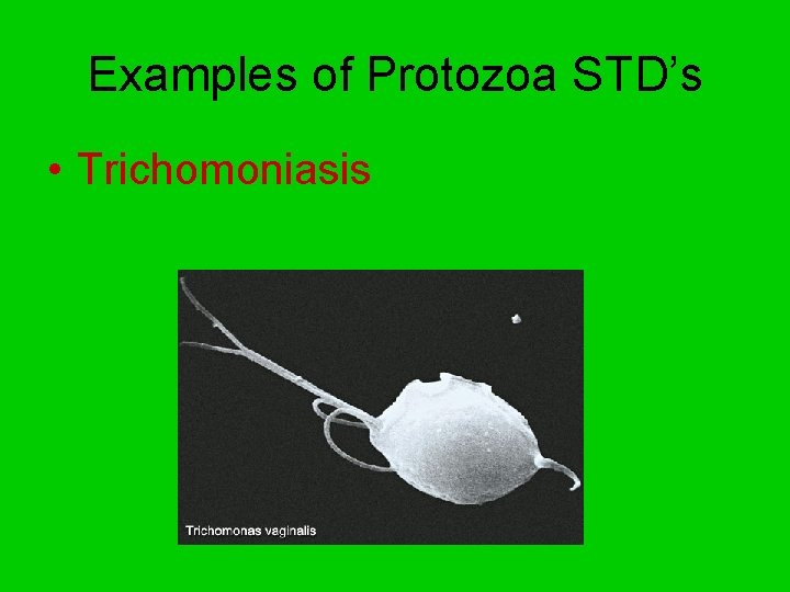 Examples of Protozoa STD’s • Trichomoniasis 