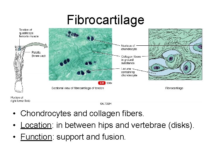 Fibrocartilage • Chondrocytes and collagen fibers. • Location: in between hips and vertebrae (disks).