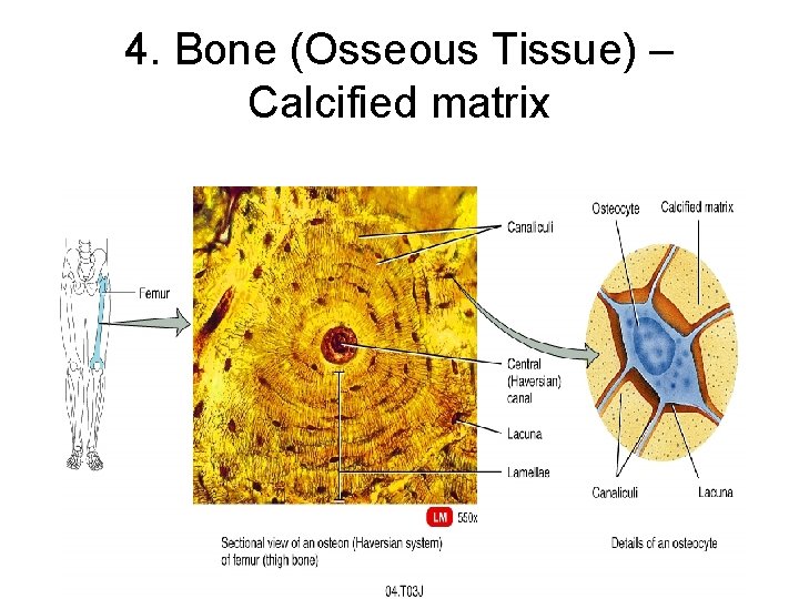 4. Bone (Osseous Tissue) – Calcified matrix 