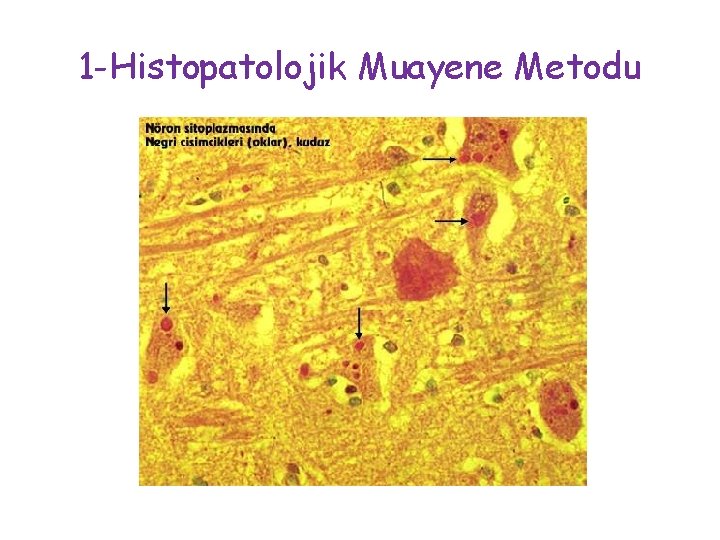 1 -Histopatolojik Muayene Metodu 1 -Histopatolojik Muayene Metodu