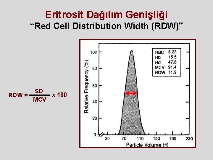 Eritrosit Dağılım Genişliği “Red Cell Distribution Width (RDW)” SD x 100 RDW = MCV Eritrosit Dağılım Genişliği “Red Cell Distribution Width (RDW)” SD x 100 RDW = MCV