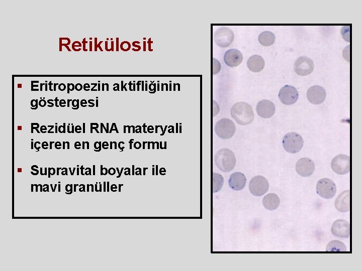 Retikülosit § Eritropoezin aktifliğinin göstergesi § Rezidüel RNA materyali içeren en genç formu § Retikülosit § Eritropoezin aktifliğinin göstergesi § Rezidüel RNA materyali içeren en genç formu §