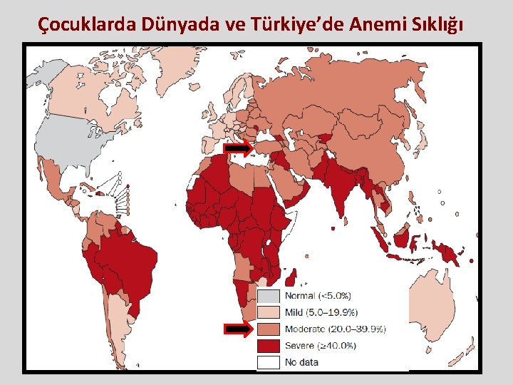 Çocuklarda Dünyada ve Türkiye’de Anemi Sıklığı Çocuklarda Dünyada ve Türkiye’de Anemi Sıklığı