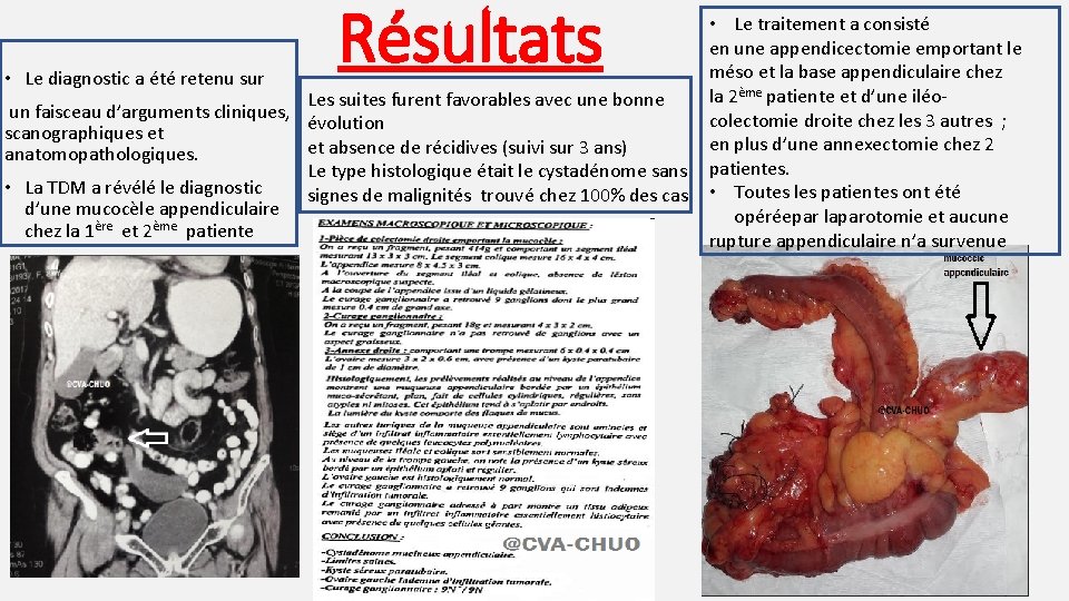  • Le diagnostic a été retenu sur Résultats Les suites furent favorables avec