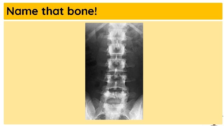 Name that bone! 
