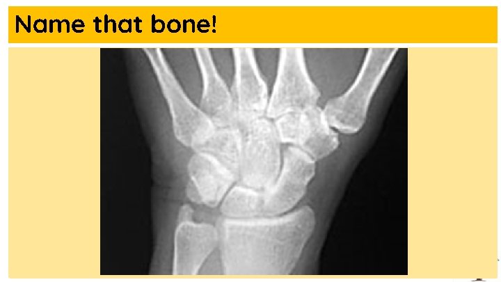 Name that bone! 