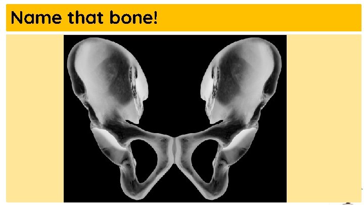 Name that bone! 