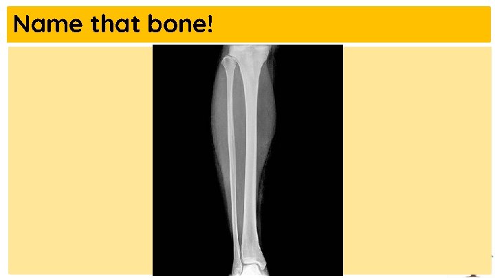 Name that bone! 