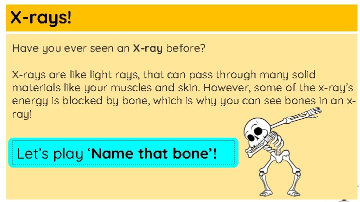 X-rays! Have you ever seen an X-ray before? X-rays are like light rays, that