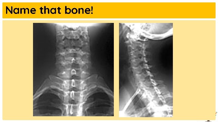Name that bone! 