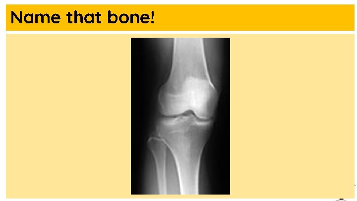 Name that bone! 