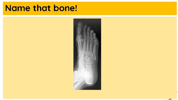 Name that bone! 