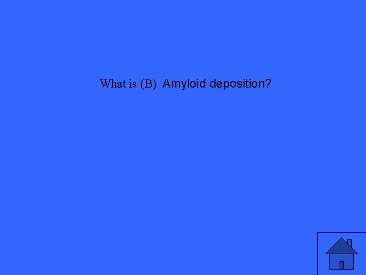 What is (B) Amyloid deposition? 