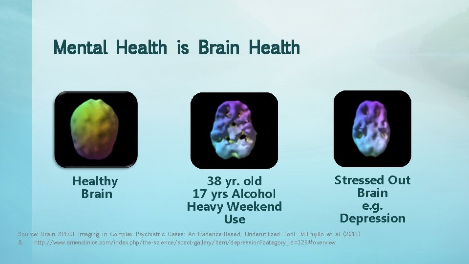 Mental Health is Brain Healthy Brain 38 yr. old 17 yrs Alcohol Heavy Weekend