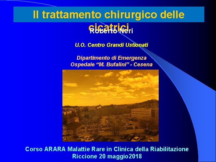 Il trattamento chirurgico delle cicatrici Roberto Neri U. O. Centro Grandi Ustionati Dipartimento di