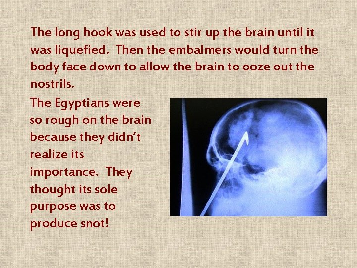 The long hook was used to stir up the brain until it was liquefied.