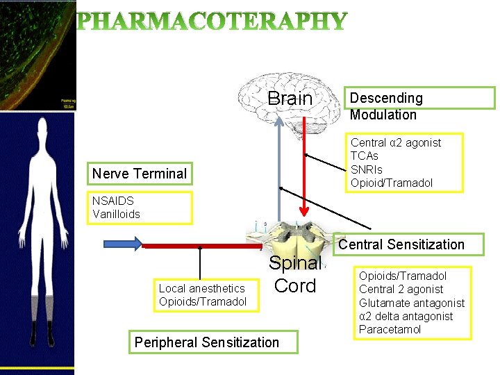 PHARMACOTERAPHY Brain Descending Modulation Central α 2 agonist TCAs SNRIs Opioid/Tramadol Nerve Terminal NSAIDS