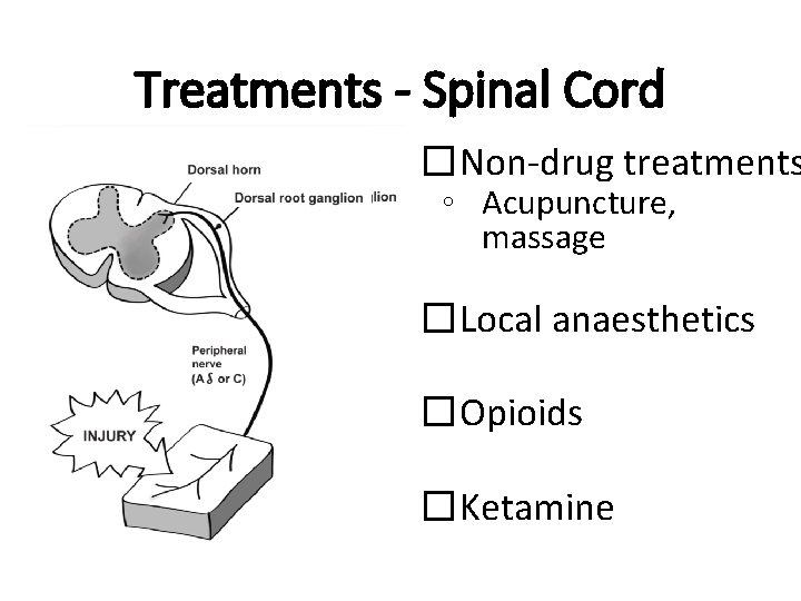 Treatments - Spinal Cord �Non-drug treatments ◦ Acupuncture, massage �Local anaesthetics �Opioids �Ketamine 
