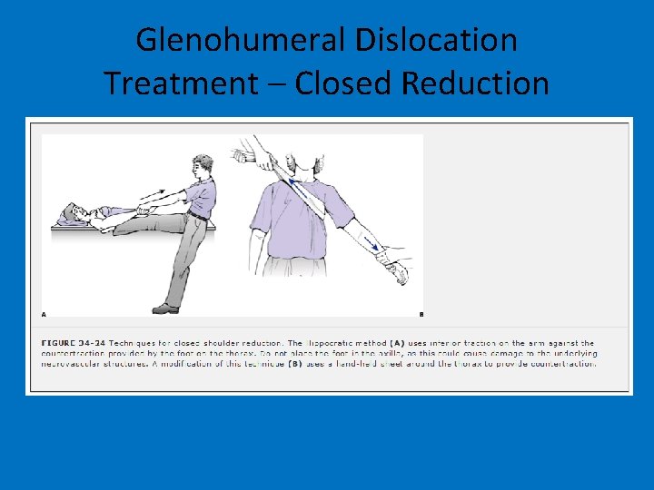 Glenohumeral Dislocation Treatment – Closed Reduction 