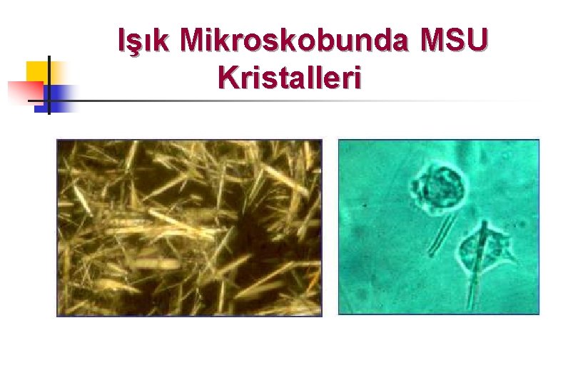 Işık Mikroskobunda MSU Kristalleri 