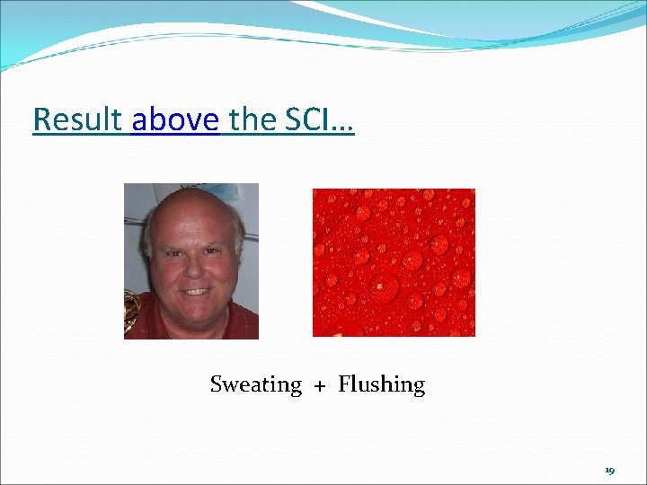 Result above the SCI… Sweating + Flushing 19 