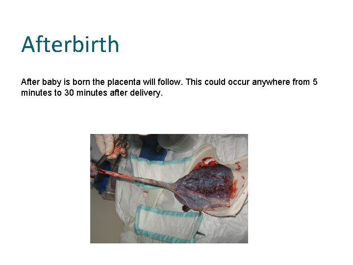Afterbirth After baby is born the placenta will follow. This could occur anywhere from