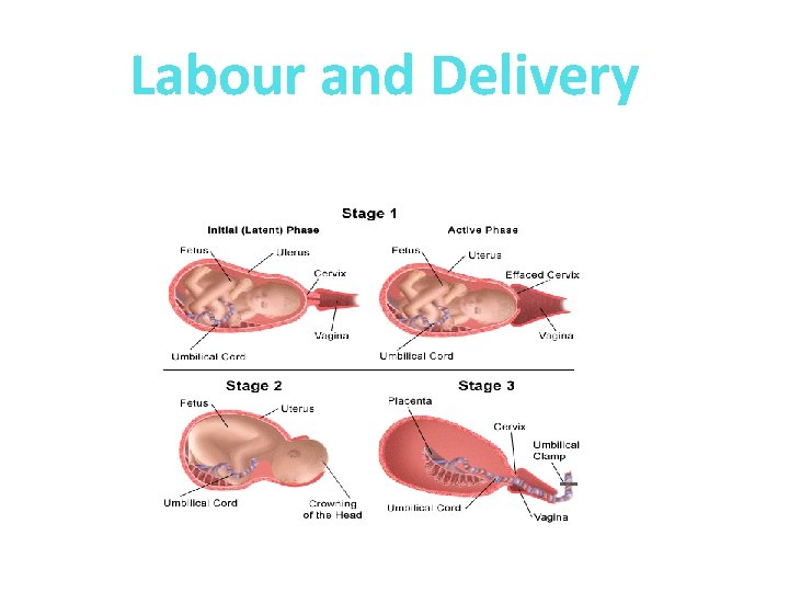 Labour and Delivery 