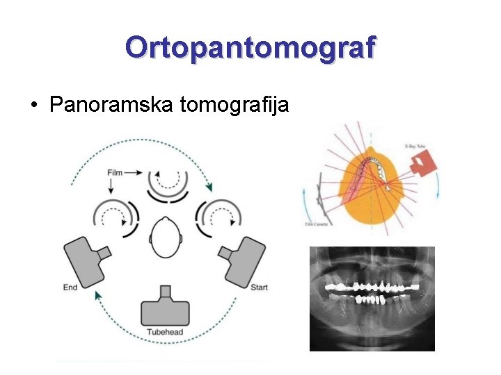 Ortopantomograf • Panoramska tomografija 