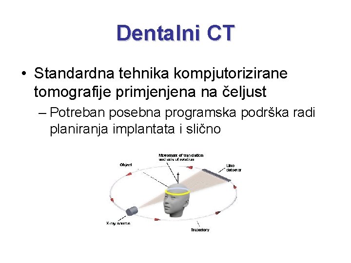 Dentalni CT • Standardna tehnika kompjutorizirane tomografije primjenjena na čeljust – Potreban posebna programska