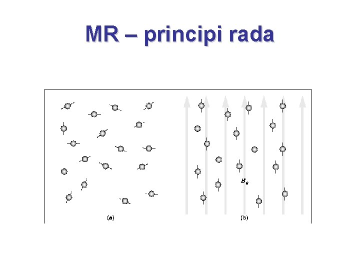 MR – principi rada 