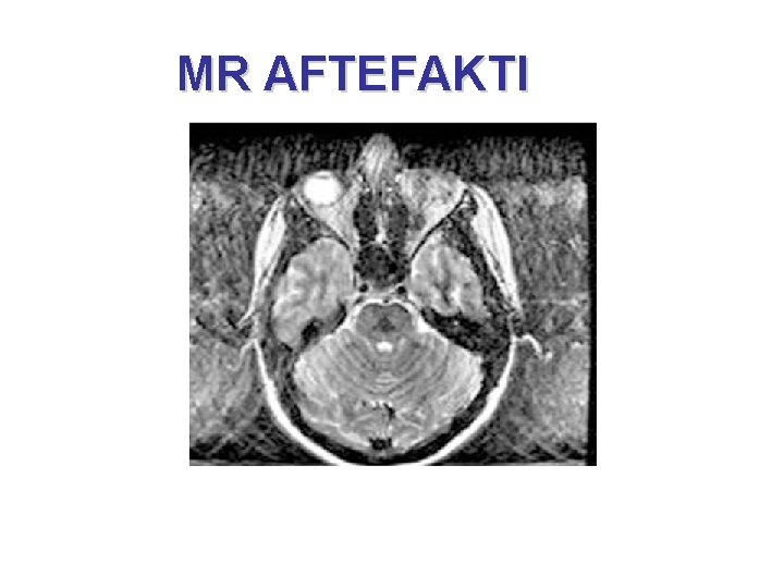 MR AFTEFAKTI 