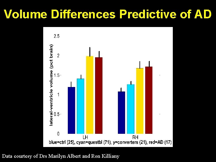 Volume Differences Predictive of AD Data courtesy of Drs Marilyn Albert and Ron Killiany