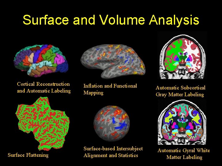 Surface and Volume Analysis Cortical Reconstruction and Automatic Labeling Surface Flattening Inflation and Functional