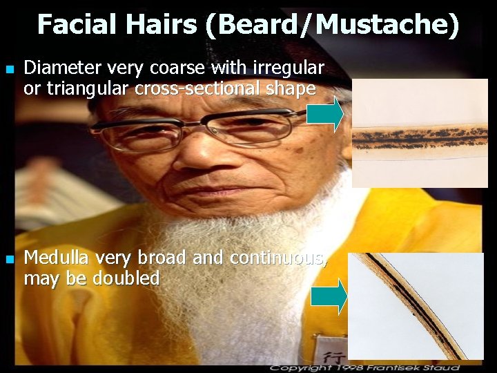 Facial Hairs (Beard/Mustache) n n Diameter very coarse with irregular or triangular cross-sectional shape Facial Hairs (Beard/Mustache) n n Diameter very coarse with irregular or triangular cross-sectional shape