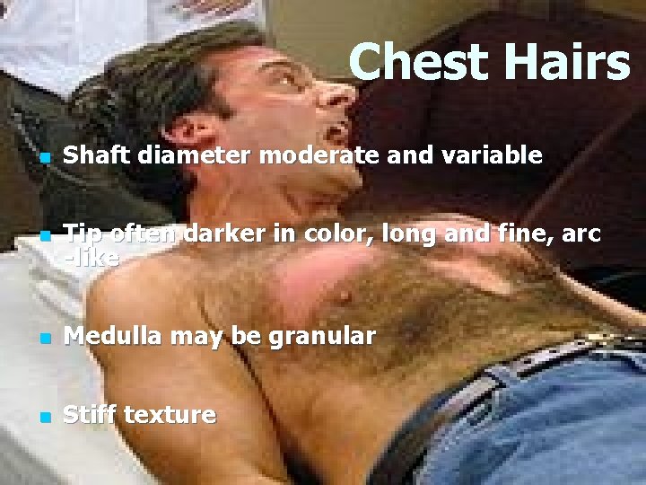 Chest Hairs n Shaft diameter moderate and variable n Tip often darker in color, Chest Hairs n Shaft diameter moderate and variable n Tip often darker in color,