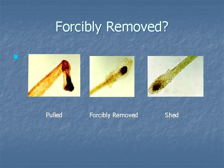 Forcibly Removed? n Pulled Forcibly Removed Shed Forcibly Removed? n Pulled Forcibly Removed Shed