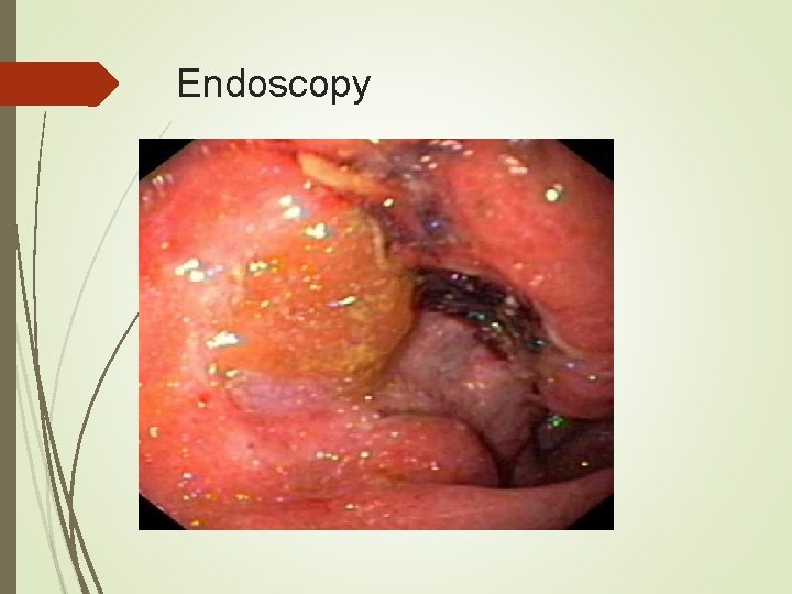 Endoscopy 