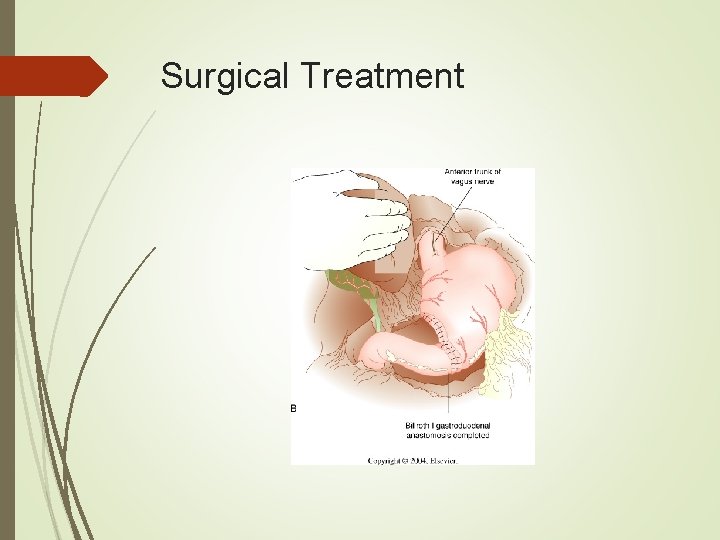 Surgical Treatment 