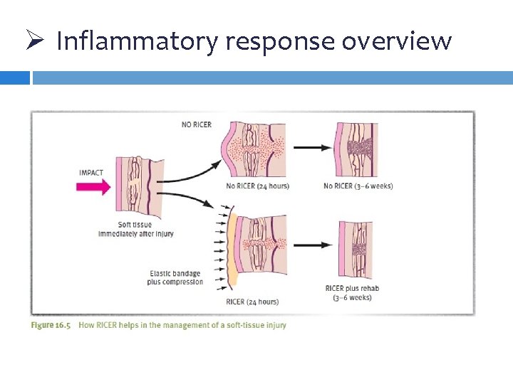 Ø Inflammatory response overview 