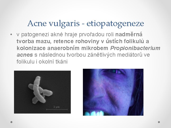 Acne vulgaris - etiopatogeneze • v patogenezi akné hraje prvořadou roli nadměrná tvorba mazu,