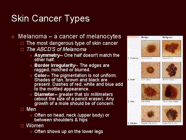 Skin Cancer Types n Melanoma – a cancer of melanocytes ¨ ¨ The most